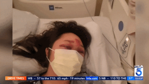 37岁华人女子在Costco遇袭：惨遭殴打+拖行数十米！头部受创，面部骨折撕裂（组图） - 1