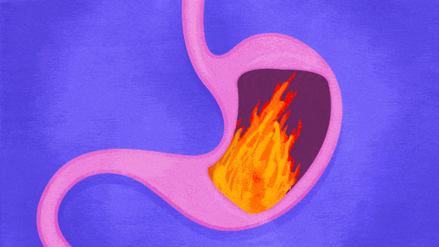 胃病变成“胃癌”前，曾用5个症状提醒你（组图） - 2