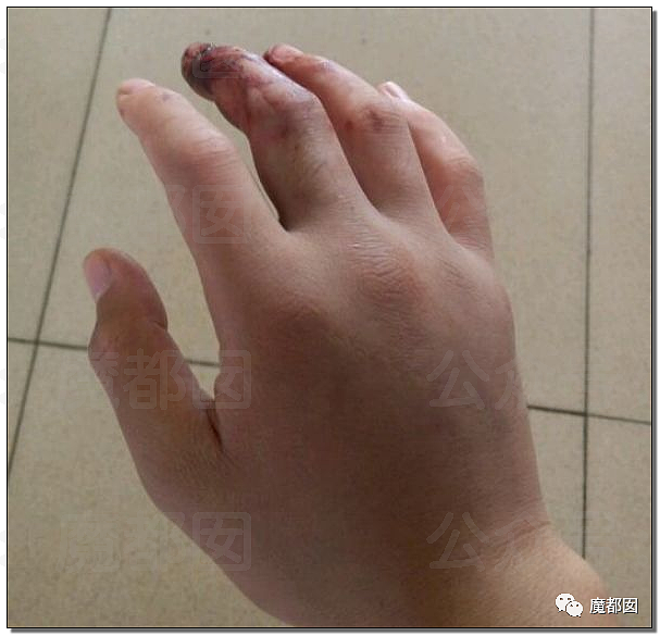 震惊！上海外滩顶级奢华酒店漂亮女住客在房内被蛇咬伤（组图） - 23