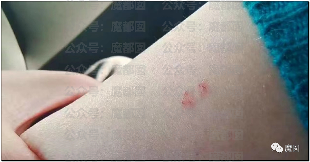 震惊！上海外滩顶级奢华酒店漂亮女住客在房内被蛇咬伤（组图） - 4