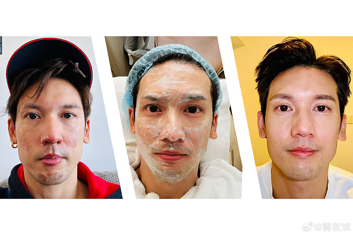 42岁“香港第一美男”，被烧成这样......（组图） - 3
