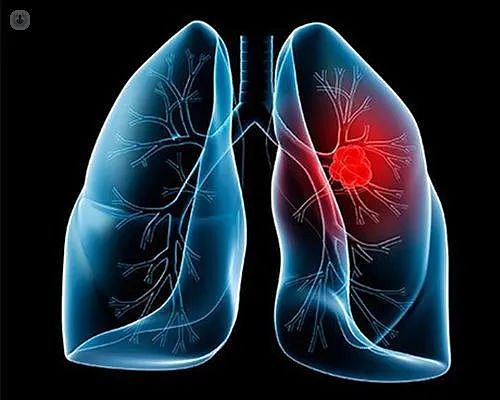 3种维生素可能导致肺癌或乳腺癌增长？这一类人应避免服用（组图） - 16