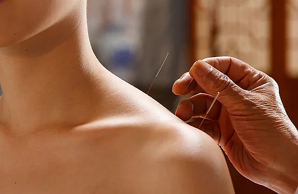 太美起色心？新西兰中式针灸师按揉女子胸部，称“你需要这个”，后用仪器伸向其两腿间...（组图） - 2