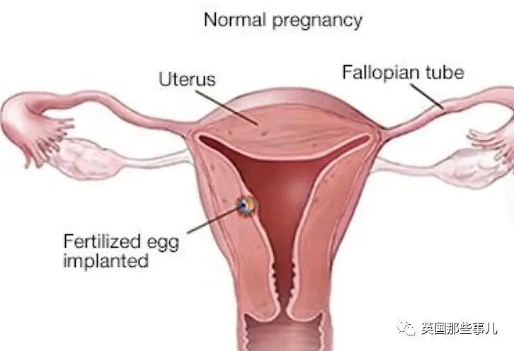 女子胃疼10多天不见好转，检查才发现大肠附近有个胎儿，已经23周大（组图） - 2