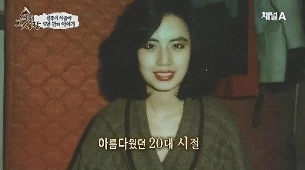 整容上瘾的韩女星：把脸整成电风扇，自行注射食用油，最后怎样了（组图） - 13