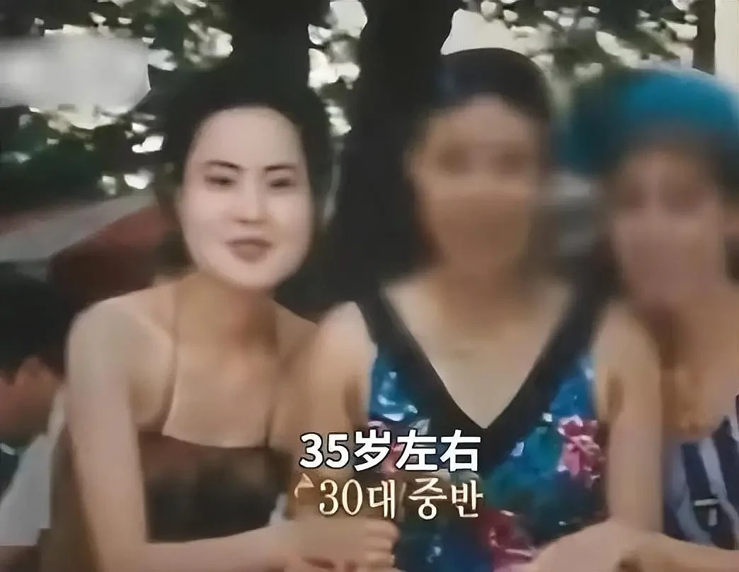 整容上瘾的韩女星：把脸整成电风扇，自行注射食用油，最后怎样了（组图） - 18
