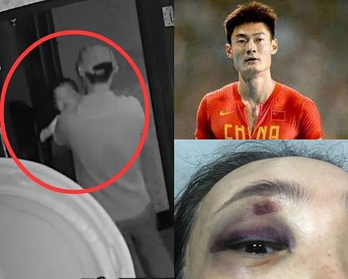 短跑名将张培萌殴打外母而遭行拘5日！前妻曾长文控诉被家暴（组图） - 2