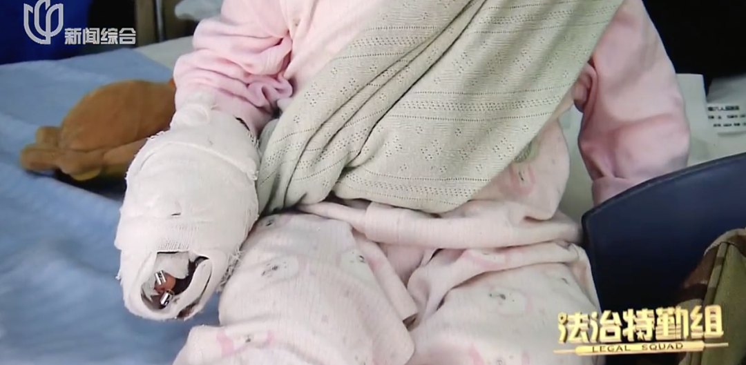 血压高了！19个月幼童被扶梯夹断手指，上海一商场惨被家长划分主要责任并索赔5.7万，法院这样判...（视频/组图） - 13