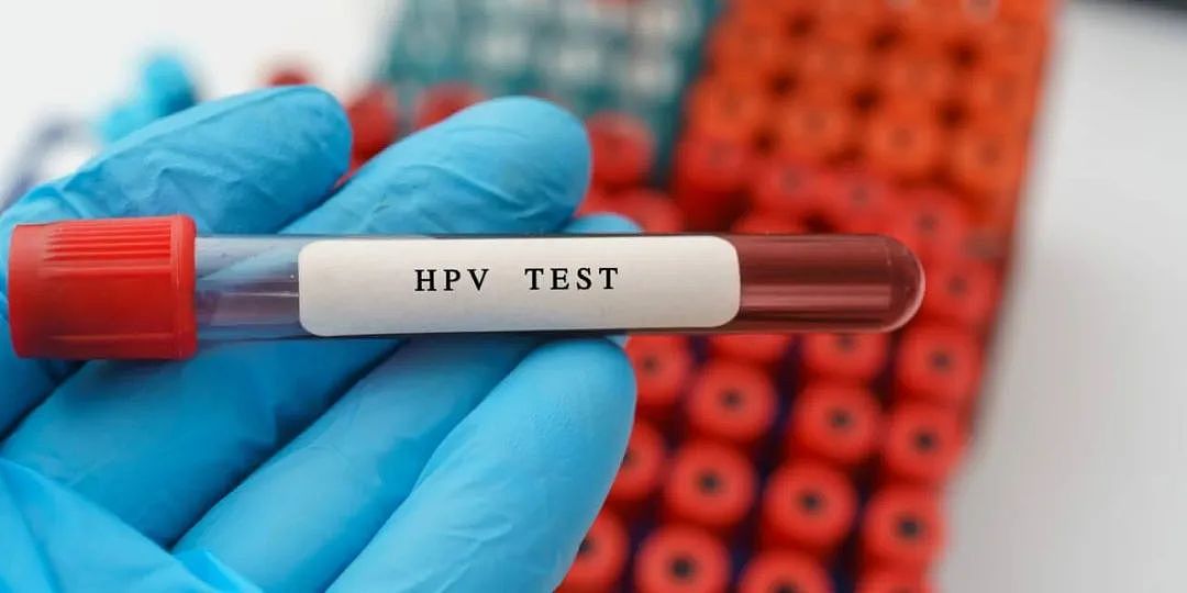 HPV感染，到底有没有“特效药”？（组图） - 7