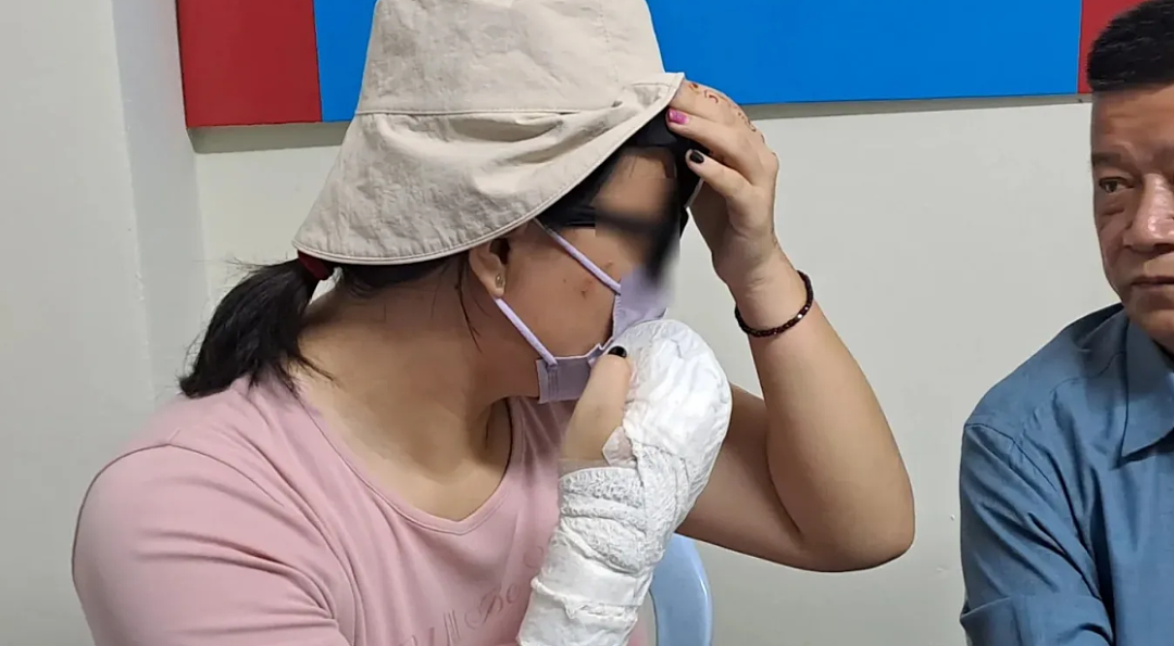 离奇！22岁中国留学生惨遭网约车司机殴打：多处肿胀+骨裂（组图） - 3