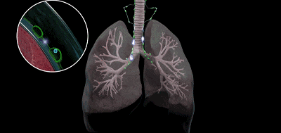 血糖高，易肺部感染！各个器官就像泡在糖水里（组图） - 1