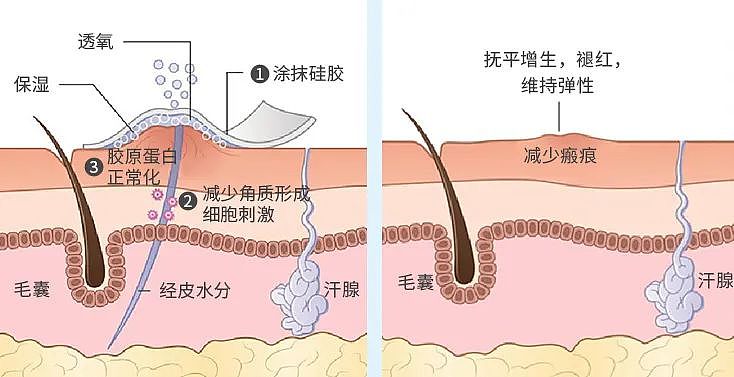 ​【时尚】消费降级后，我​被这 5 件“高性价比好物”治愈了（组图） - 40