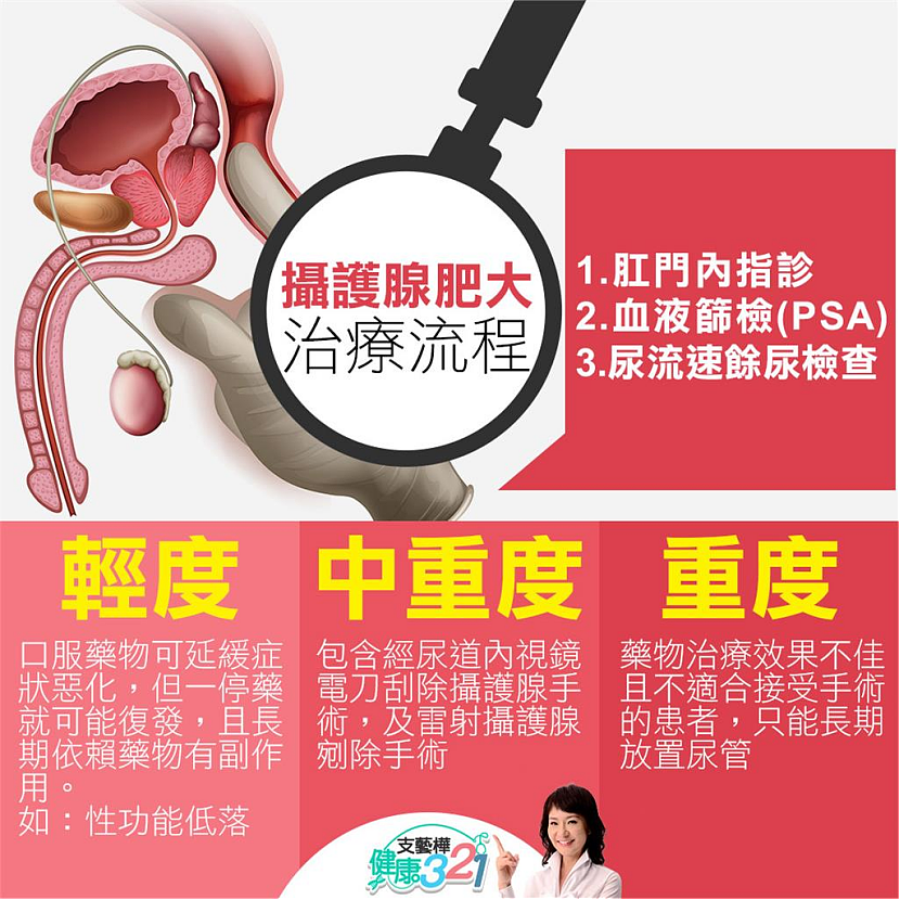 查尔斯前列腺手术细节公开！中国200多万男性患前列腺肥大（组图） - 23
