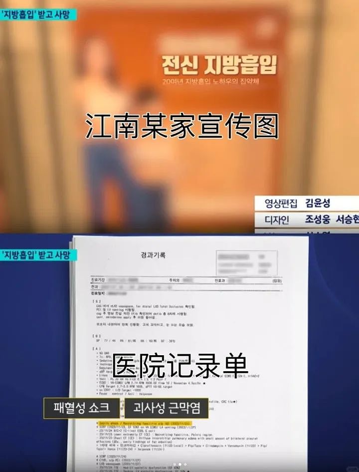 两周内三次抽脂，中国女孩命丧韩国！警方介入调查（组图） - 3