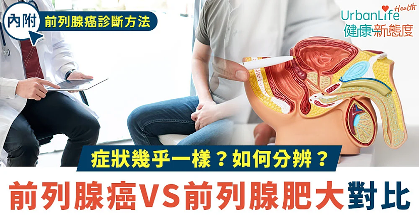 查尔斯前列腺手术细节公开！中国200多万男性患前列腺肥大（组图） - 15