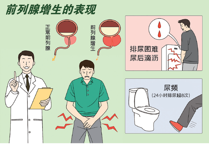 查尔斯前列腺手术细节公开！中国200多万男性患前列腺肥大（组图） - 13