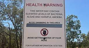 澳洲海滩惊现“食脑虫”，已有孩童因此丧命！新州政府发警告：近期下水要注意（组图） - 24