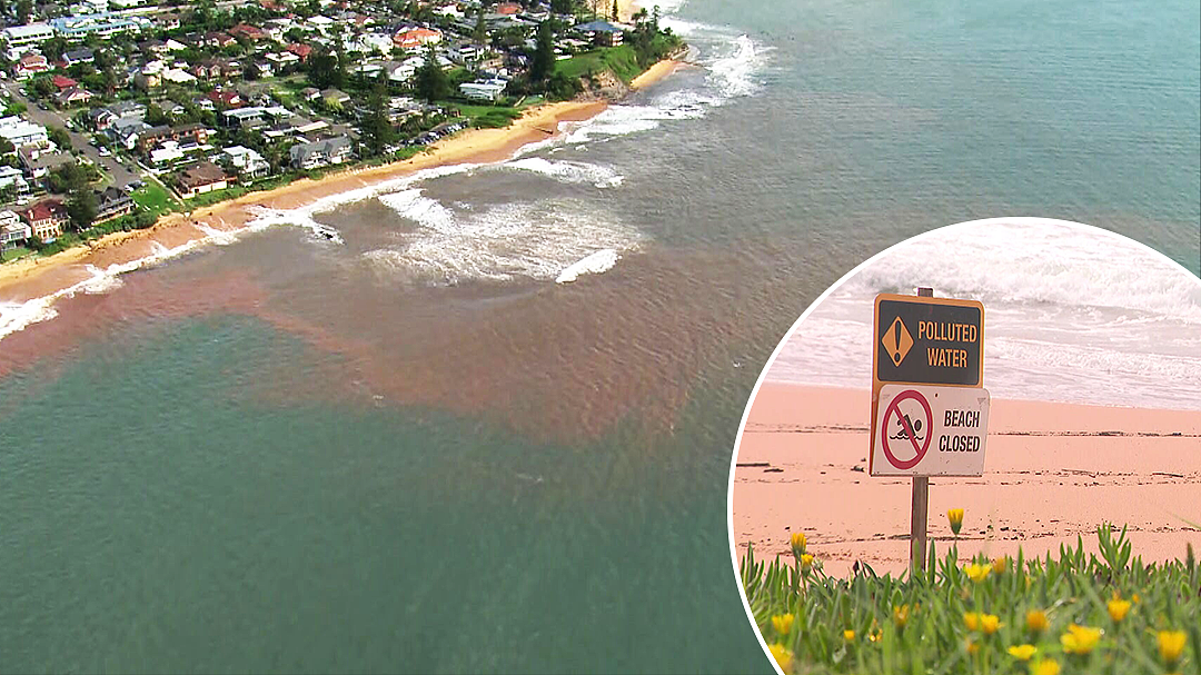 澳洲海滩惊现“食脑虫”，已有孩童因此丧命！新州政府发警告：近期下水要注意（组图） - 7
