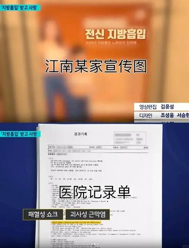 出国整形两周内三次抽脂，20多岁中国女孩不幸身亡（组图） - 4