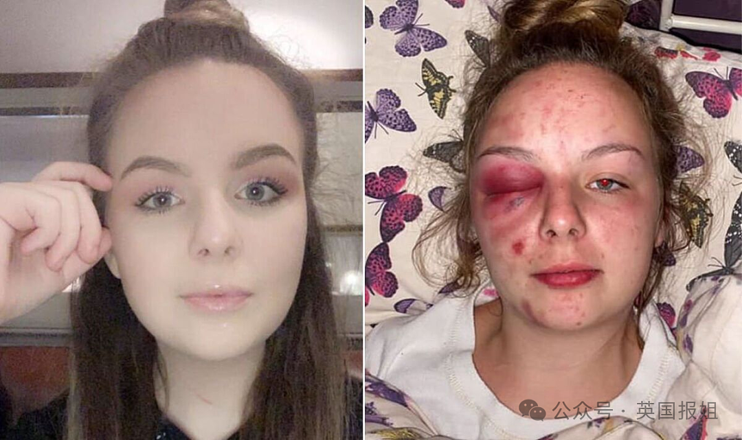 19岁女孩遭多次暴力侵犯，反被判刑8年半？真相反转震撼英国：她故意用铁锤砸自己编故事（组图） - 21