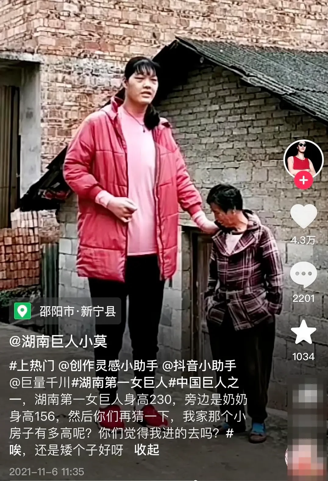 湖南23岁“网红巨人”小莫已被安葬：宁愿自己是矮个子，当一个被人呵护的婴儿（组图） - 3