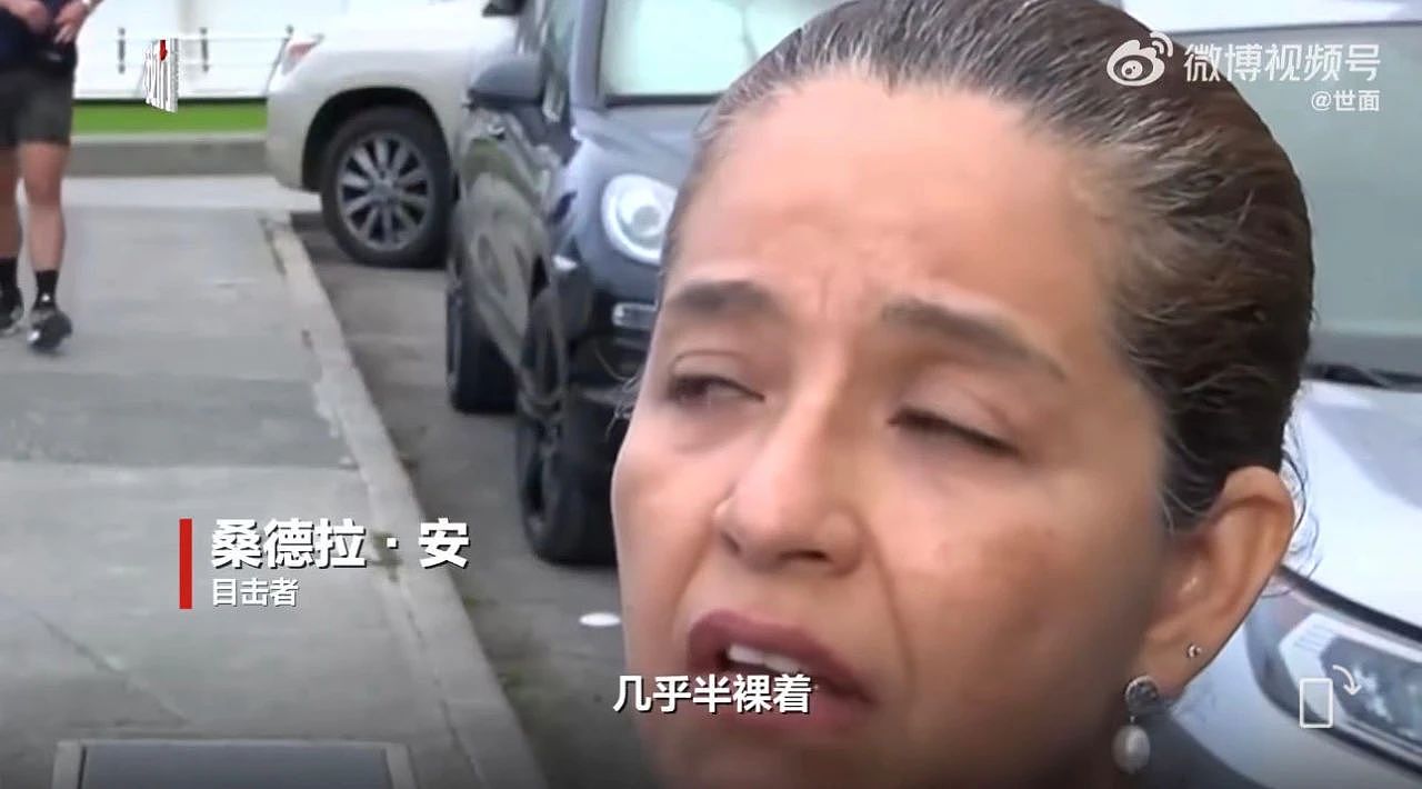 “衣服像解体了，几乎半裸“！25岁中国女子街头被泼化学液体，严重烧伤（组图） - 6