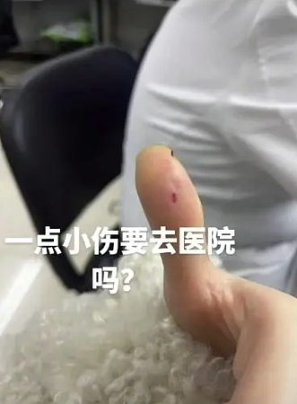 西安女子手指遭竹筷刺伤送医手术！医药费高达7万元傻眼了（组图） - 1