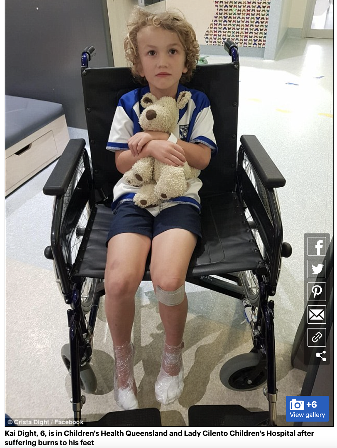 悉尼最热门的公园出意外，5岁男童伤势严重紧急入院！夏季户外场地危机四伏，妈妈们一定要注意（组图） - 20