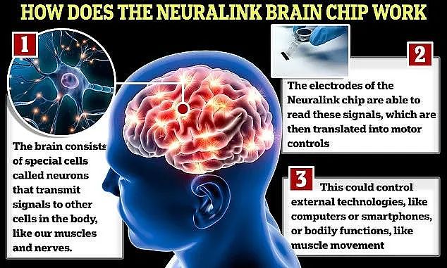 人类里程碑！马斯克宣布：脑机接口芯片首次植入大脑，可用意念操作手机（组图） - 3
