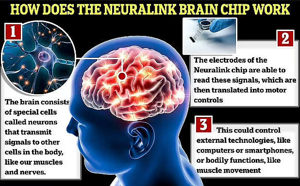 大消息！马斯克：人类首次植入脑机接口芯片，科幻帝国“又一壮举”（组图） - 5