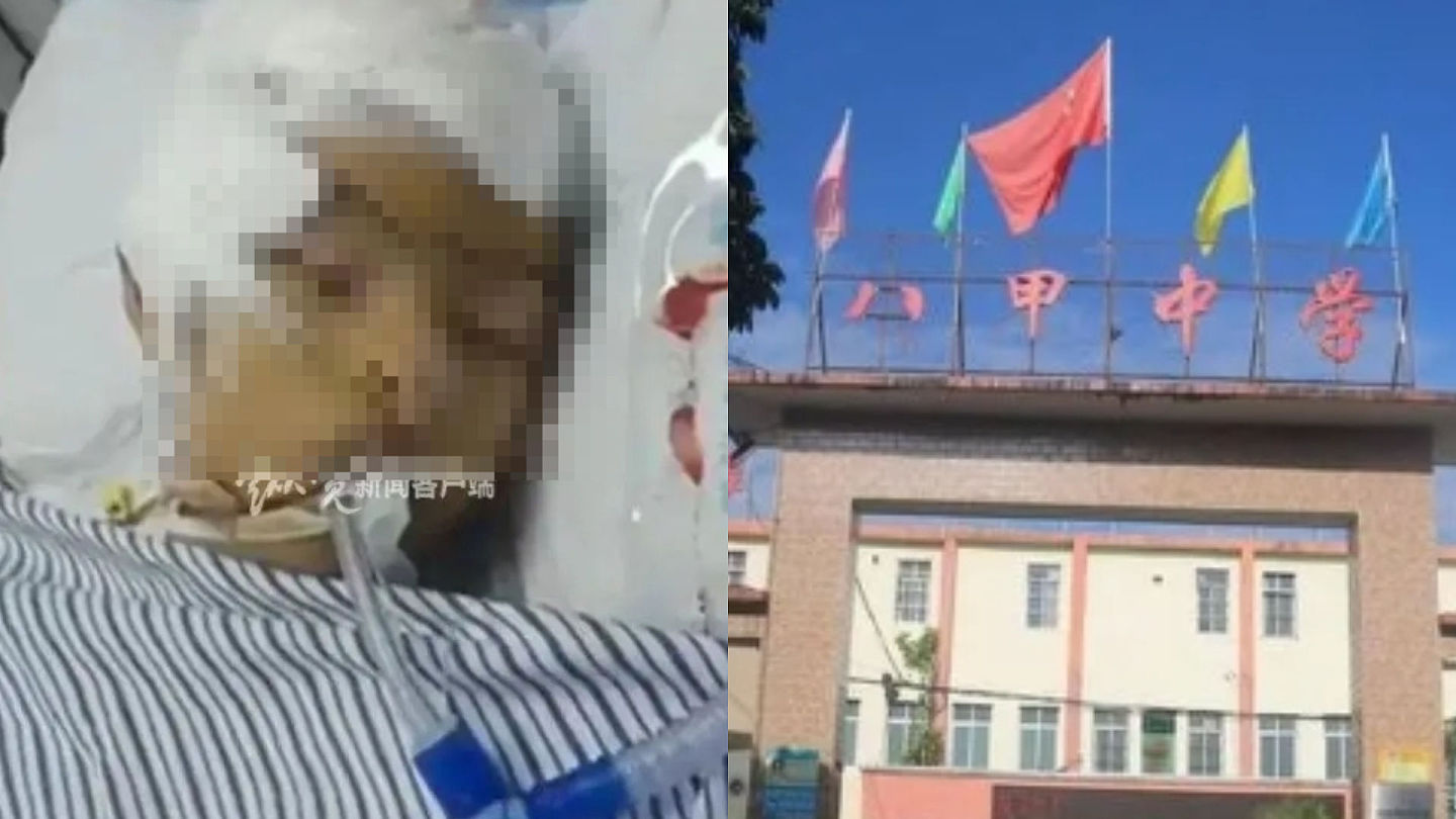 广东13岁男被同学扫把打到脑死！捐器官救7人，父悲痛：别再有霸凌（组图） - 1