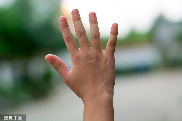 手指长度看穿你？研究：无名指比食指长，与精神疾病倾向有关（组图） - 1