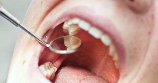 男子牙痛 一查竟是癌症，下巴被切掉，被告知只能活6年（组图） - 3