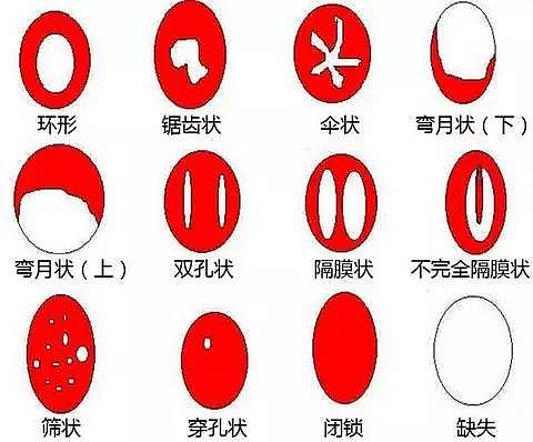 私处粉嫩整形，春节挤爆中国各地美容院（组图） - 7