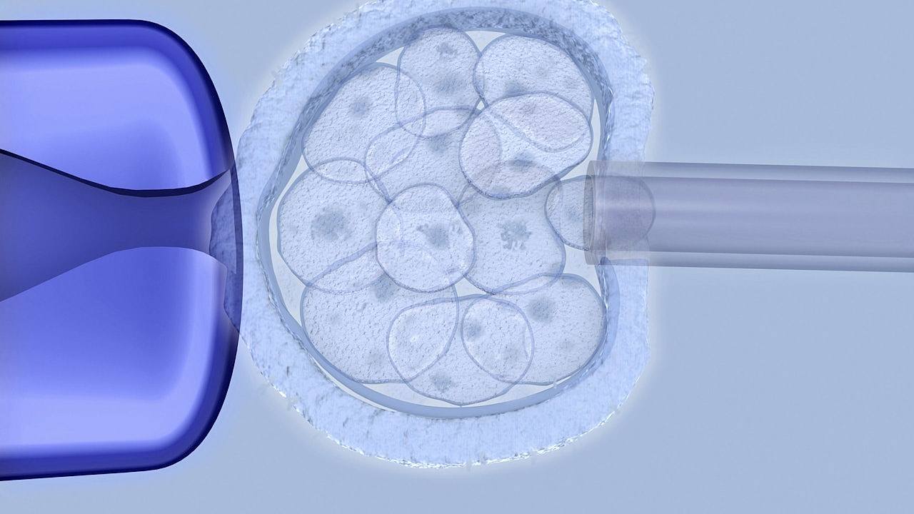 美国阿拉巴马州法院裁决惹议：冷冻胚胎视同“儿童”，销毁恐犯法（组图） - 1