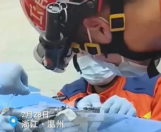 闹大了！温州一男子下体被轴承圈套住，严重肿胀，医生消防联手（组图） - 2