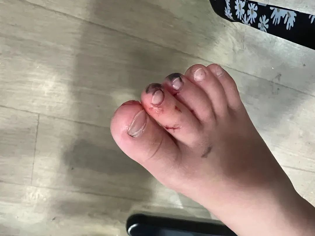 妈妈们小心！悉尼华人区商场扶梯事故频发，华裔男童脚被卷入受伤，大量网友吐槽：“三天两头坏！”（组图） - 13