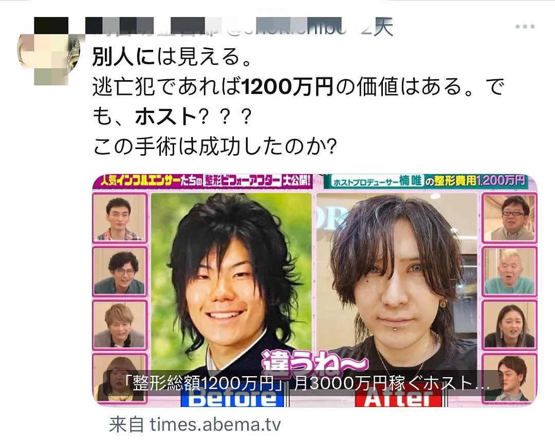 日本男子砸1200万换头整容，如今靠脸月入3000万，直言：太值了（组图） - 25