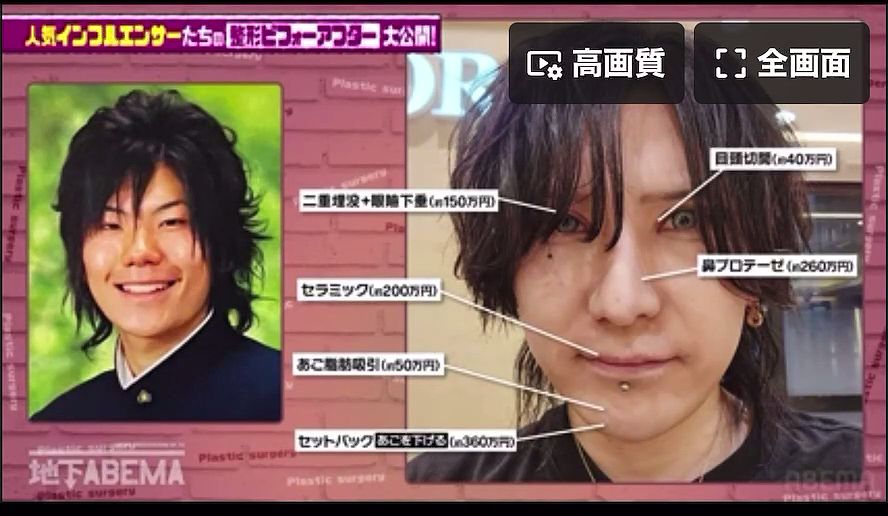日本男子砸1200万换头整容，如今靠脸月入3000万，直言：太值了（组图） - 21