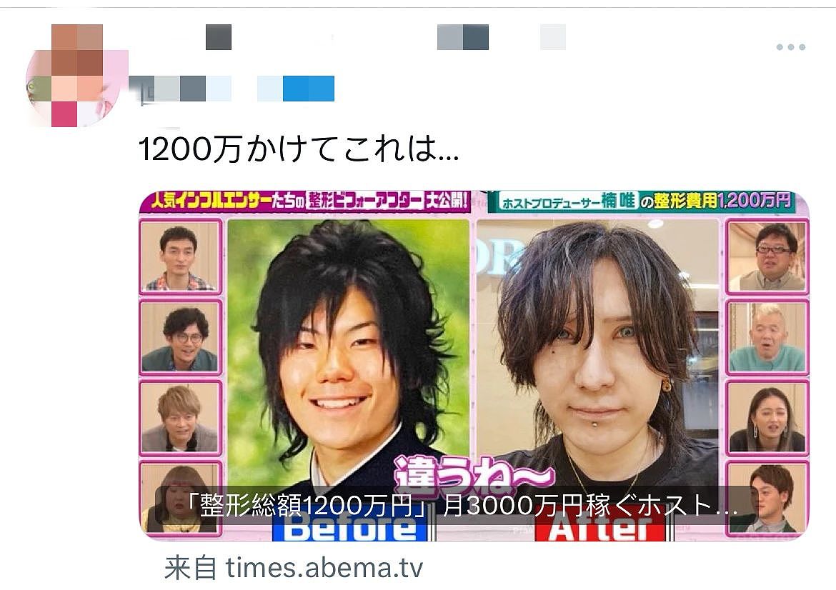 日本男子砸1200万换头整容，如今靠脸月入3000万，直言：太值了（组图） - 26
