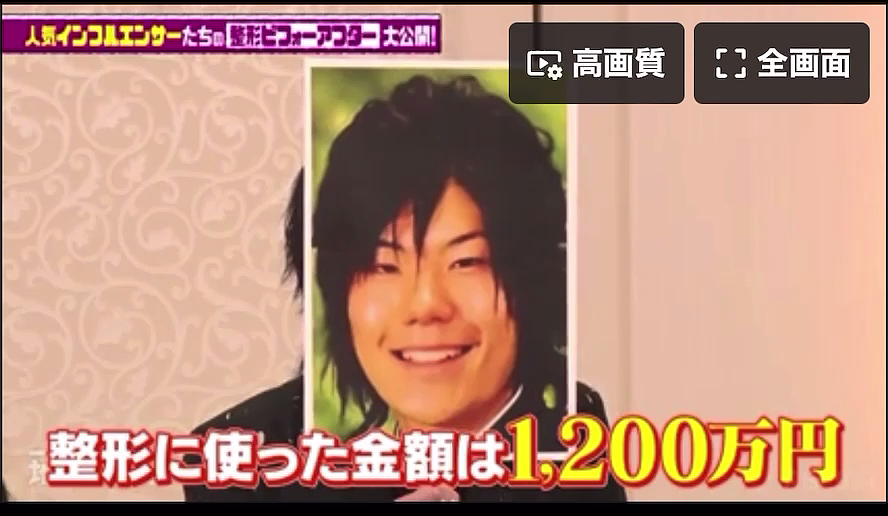 日本男子砸1200万换头整容，如今靠脸月入3000万，直言：太值了（组图） - 20