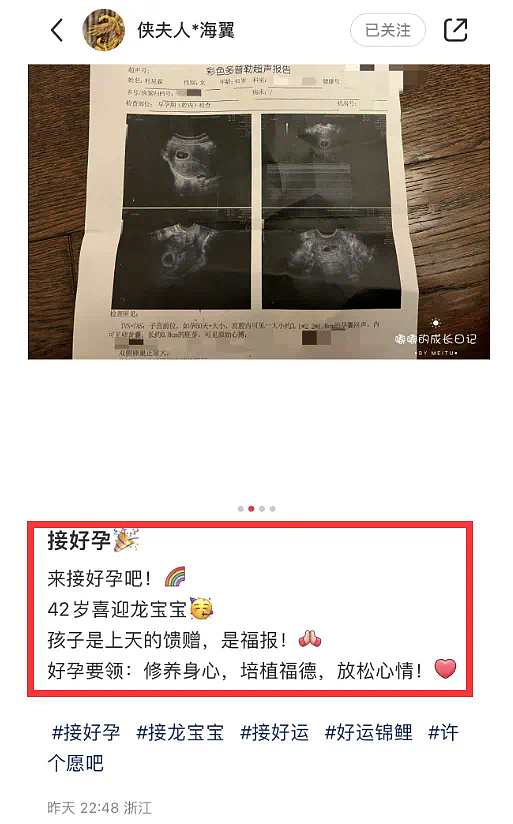 72岁张纪中已七度当爹！自曝精力充沛胜过年轻人，混血儿子生父存疑（组图） - 1