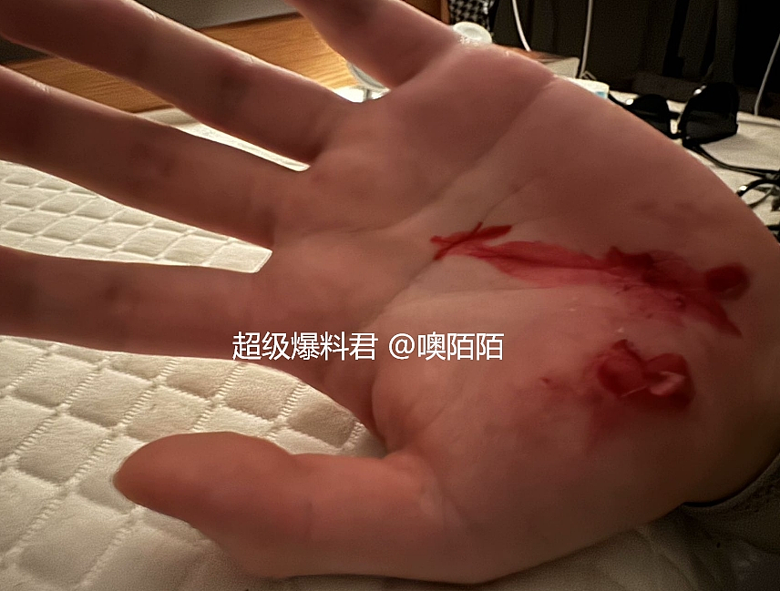 加国华人在家门口被抢手机！被车拖50米！手掌腿上全是血...（组图） - 2