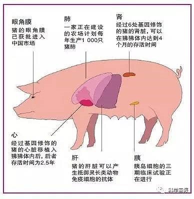世界首例！中国完成将“基因编辑”猪肝移置到人体，已无排拆工作96小时（组图） - 5