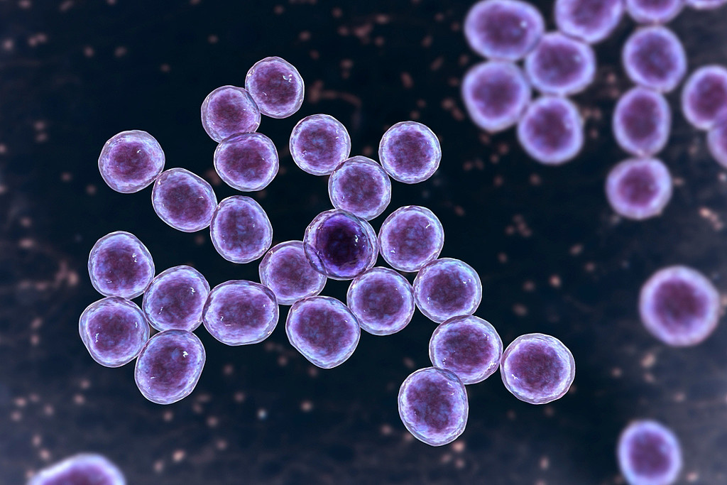 澳洲一名29岁女子感染超级细菌「抗甲氧苯青霉素金黄色葡萄球菌」，肺部「布满了洞」。 （资料照：shutterstock／达志）