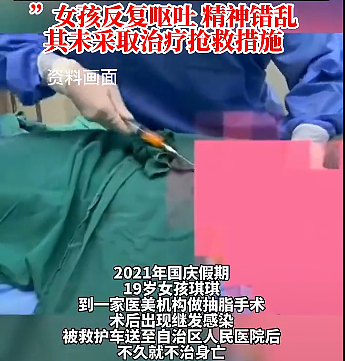 上海24岁女孩整容失败后自杀身亡，前后颜值照曝光，网友：太可惜了（组图） - 10