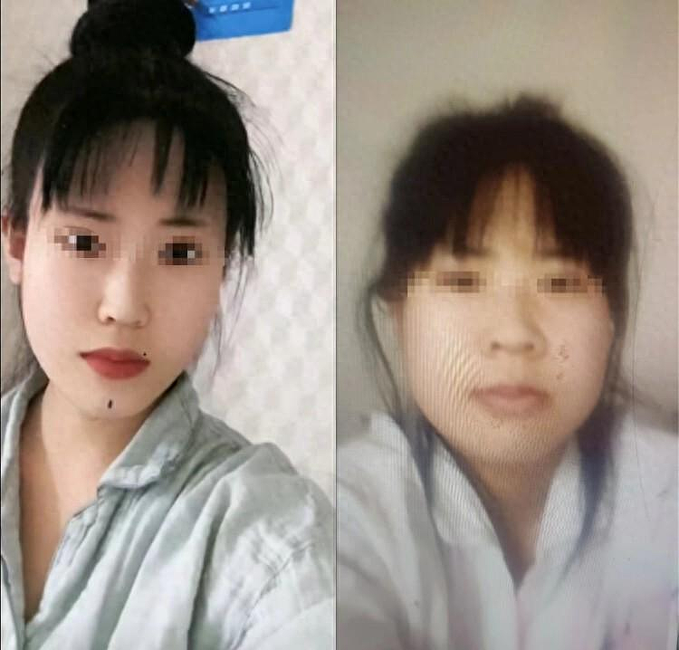上海24岁女孩整容失败后自杀身亡，前后颜值照曝光，网友：太可惜了（组图） - 3