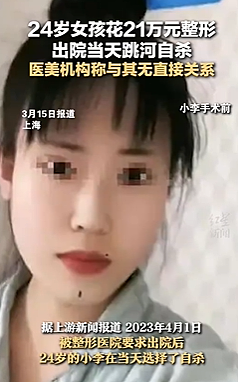 上海24岁女孩整容失败后自杀身亡，前后颜值照曝光，网友：太可惜了（组图） - 5