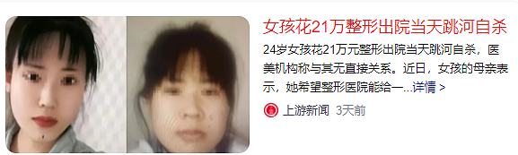 上海24岁女孩整容失败后自杀身亡，前后颜值照曝光，网友：太可惜了（组图） - 1