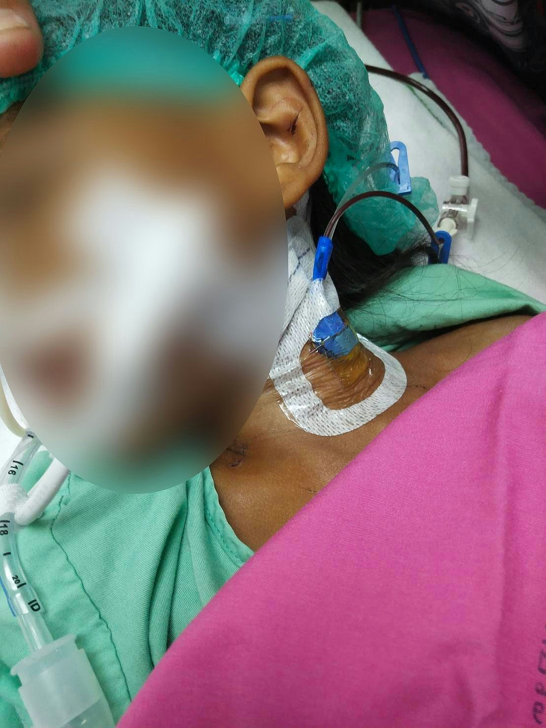 泰国4岁女童疑遭母亲朋友残虐性侵致阴道撕裂，大脑受损昏迷（组图） - 2